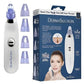 Electric Blackhead Remover Vacuum – Deep Pore Cleansing Tool
