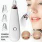 Electric Blackhead Remover Vacuum – Deep Pore Cleansing Tool