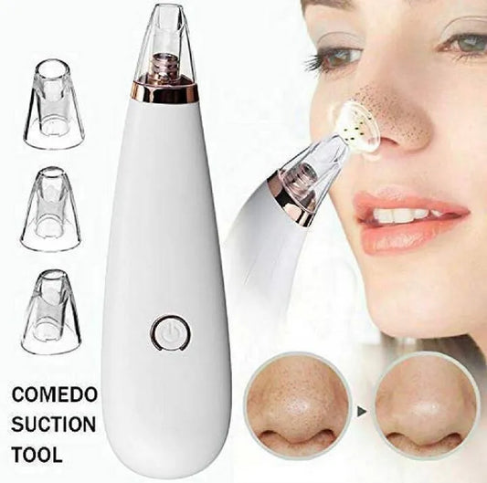 Electric Blackhead Remover Vacuum – Deep Pore Cleansing Tool