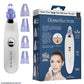 Electric Blackhead Remover Vacuum – Deep Pore Cleansing Tool