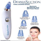 Electric Blackhead Remover Vacuum – Deep Pore Cleansing Tool